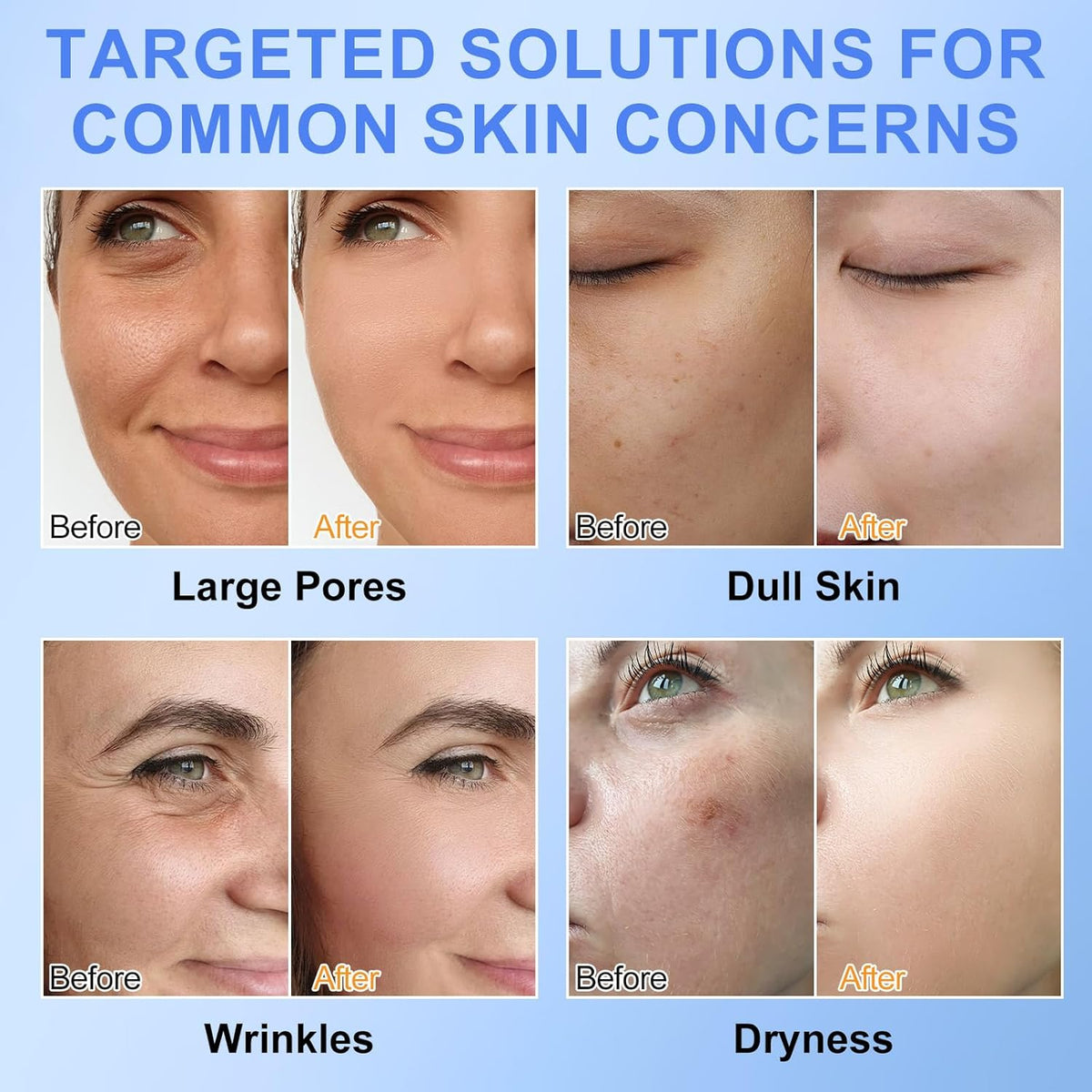 Revitalize Your Skin Overnight with Our Bio Collagen Deep Hydration Face Mask - 6 Pack for Ultimate Moisture and Firmness